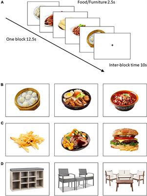 Neural responsiveness to Chinese versus Western food images: An functional magnetic resonance imaging study of Chinese young adults